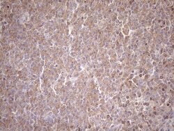 TNFRSF10B Mouse anti-Human, Mouse, Clone: OTI2A5, liquid, TrueMAB 100 &mu;L;