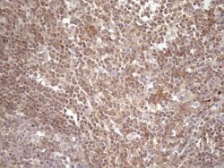 TNFRSF10B Mouse anti-Human, Mouse, Clone: OTI2A5, liquid, TrueMAB 100 &mu;L;