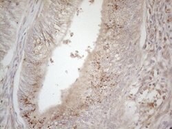 TNFRSF10B Mouse anti-Human, Mouse, Clone: OTI2A5, liquid, TrueMAB 100 &mu;L;