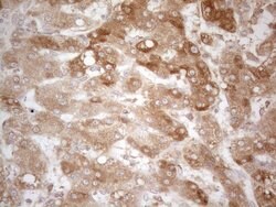 TNFRSF10B Mouse anti-Human, Mouse, Clone: OTI2A5, liquid, TrueMAB 100 &mu;L;