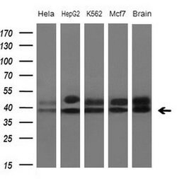 TNFRSF10B Monoclonal Antibody (OTI1B9), TrueMAB , OriGene 100 &mu;L; Unconjugated:Antibodies,