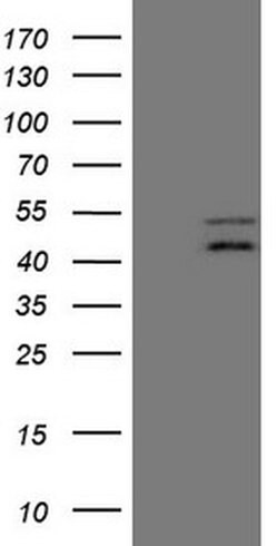 TNFRSF10B Monoclonal Antibody (OTI4B12), TrueMAB , OriGene 30 &mu;L; Unconjugated:Antibodies,