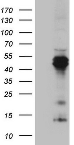 TNFRSF10B Mouse anti-Human, Mouse, Clone: OTI2A5, liquid, TrueMAB 100 &mu;L;