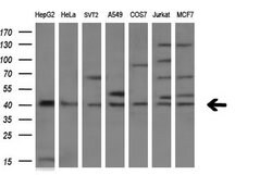 TNFRSF10B Mouse anti-Human, Mouse, Clone: OTI2A5, liquid, TrueMAB 100 &mu;L;