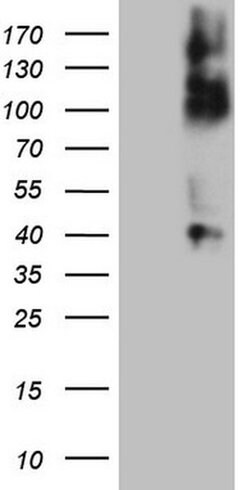 TNFRSF14 Monoclonal Antibody (OTI7D7), TrueMAB , OriGene:Antibodies:Primary