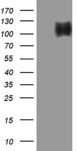 TNFRSF14 Monoclonal Antibody (OTI1F12), TrueMAB , OriGene 100 &mu;L; Unconjugated:Antibodies,