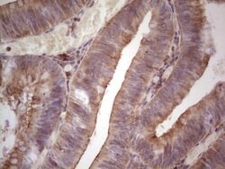 TNFRSF18 Monoclonal Antibody (OTI9G8), TrueMAB , OriGene:Antibodies:Primary