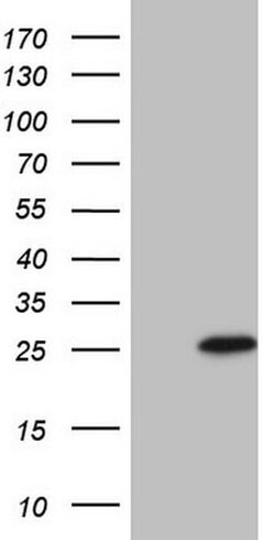 TNFRSF18 Monoclonal Antibody (OTI1A3), TrueMAB , OriGene 100 &mu;L; Unconjugated:Antibodies,