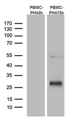 TNFRSF18 Monoclonal Antibody (OTI1A3), TrueMAB , OriGene:Antibodies:Primary