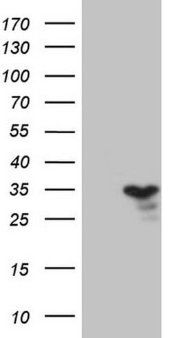 TNFRSF18 Monoclonal Antibody (OTI3A7), TrueMAB , OriGene:Antibodies:Primary