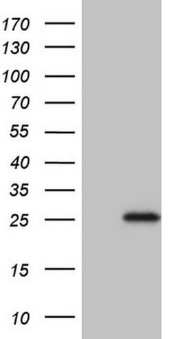 TNFRSF18 Monoclonal Antibody (OTI1C4), TrueMAB , OriGene 100 &mu;L; Unconjugated:Antibodies,