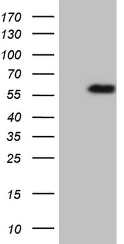 TNFRSF19 Monoclonal Antibody (OTI1B7), TrueMAB , OriGene:Antibodies:Primary