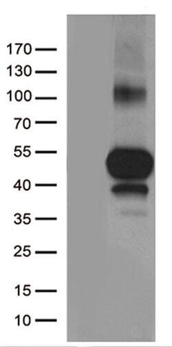 TNFRSF4 Monoclonal Antibody (OTI2B7), TrueMAB , OriGene 30 &mu;L; Unconjugated:Antibodies,