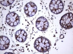 TNFRSF8 Mouse anti-Human, Clone: OTI1C6, lyophilized, TrueMAB 100 &mu;g;
