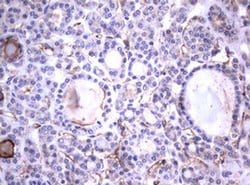 TNFRSF8 Monoclonal Antibody (OTI18D3), TrueMAB , OriGene 100 &mu;L; Unconjugated:Antibodies,