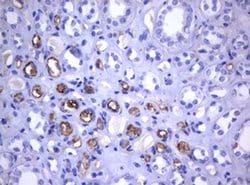 TNFRSF8 Monoclonal Antibody (OTI18D3), TrueMAB , OriGene 100 &mu;L; Unconjugated:Antibodies,