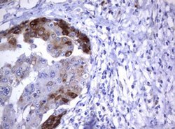 TNFRSF8 Monoclonal Antibody (OTI18D3), TrueMAB , OriGene:Antibodies:Primary