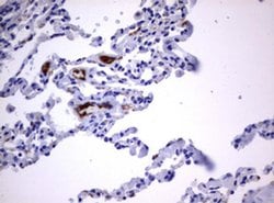 TNFRSF8 Monoclonal Antibody (OTI18D3), TrueMAB , OriGene 100 &mu;L; Unconjugated:Antibodies,