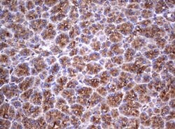 TNFRSF8 Monoclonal Antibody (OTI16H5), TrueMAB , OriGene:Antibodies:Primary