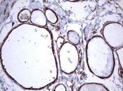 TNFRSF8 Monoclonal Antibody (OTI16H5), TrueMAB , OriGene 100 &mu;L; Unconjugated:Antibodies,