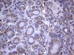 TNFRSF8 Monoclonal Antibody (OTI16H5), TrueMAB , OriGene 100 &mu;L; Unconjugated:Antibodies,