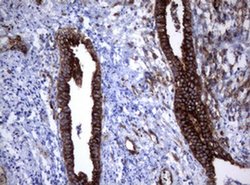 TNFRSF8 Monoclonal Antibody (OTI16H5), TrueMAB , OriGene 100 &mu;L; Unconjugated:Antibodies,