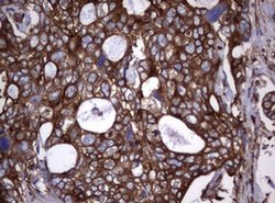 TNFRSF8 Monoclonal Antibody (OTI16H5), TrueMAB , OriGene 100 &mu;L; Unconjugated:Antibodies,