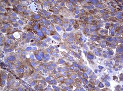 TNFRSF8 Monoclonal Antibody (OTI16H5), TrueMAB , OriGene 100 &mu;L; Unconjugated:Antibodies,