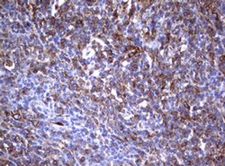 TNFRSF8 Monoclonal Antibody (OTI16H5), TrueMAB , OriGene 100 &mu;L; Unconjugated:Antibodies,