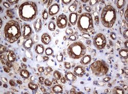 TNFRSF8 Monoclonal Antibody (OTI16H5), TrueMAB , OriGene 100 &mu;L; Unconjugated:Antibodies,