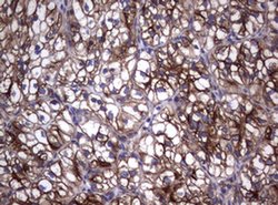 TNFRSF8 Monoclonal Antibody (OTI16H5), TrueMAB , OriGene 100 &mu;L; Unconjugated:Antibodies,