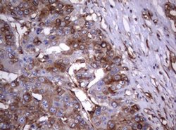 TNFRSF8 Monoclonal Antibody (OTI16H5), TrueMAB , OriGene 100 &mu;L; Unconjugated:Antibodies,