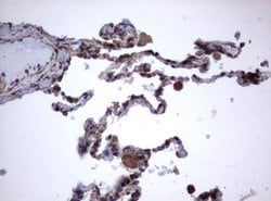 TNFRSF8 Monoclonal Antibody (OTI16H5), TrueMAB , OriGene:Antibodies:Primary