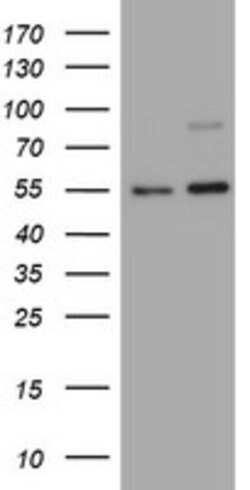 TNFRSF8 Mouse anti-Human, Clone: OTI1C6, lyophilized, TrueMAB 100 &mu;g;