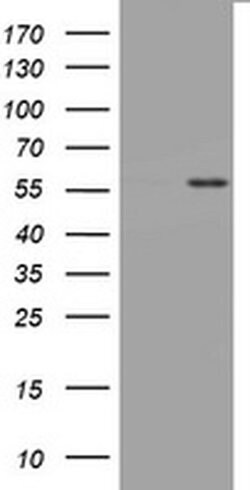 TNFRSF8 Monoclonal Antibody (OTI16H5), TrueMAB , OriGene 100 &mu;L; Unconjugated:Antibodies,