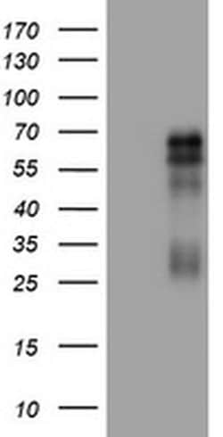 TNFRSF8 Monoclonal Antibody (OTI3F8), TrueMAB , OriGene:Antibodies:Primary