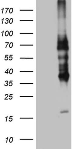 TNFRSF8 Monoclonal Antibody (OTI2H2), TrueMAB , OriGene:Antibodies:Primary