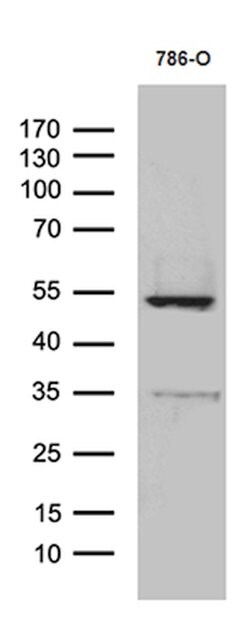 TNFSF10 Monoclonal Antibody (OTI9A8), TrueMAB , OriGene 100 &mu;L; Unconjugated:Antibodies,