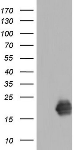 TNNC1 Monoclonal Antibody (OTI8F8), TrueMAB , OriGene 100 &mu;L; Unconjugated:Antibodies,