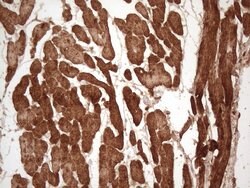 TNNI3 Monoclonal Antibody (OTI8G8), TrueMAB , OriGene 100 &mu;L; Unconjugated:Antibodies,