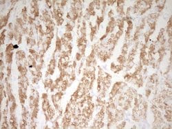 TNNI3 Monoclonal Antibody (OTI14A2), TrueMAB , OriGene:Antibodies:Primary