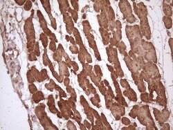 TNNI3 Mouse anti-Human, Clone: OTI4C1, lyophilized, TrueMAB 100 &mu;g;