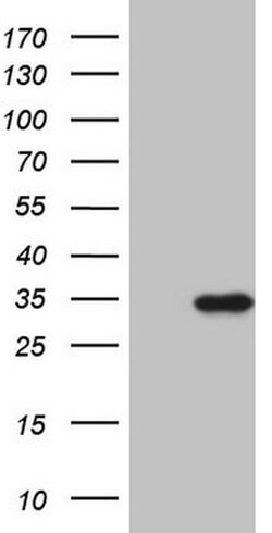TNNI3 Monoclonal Antibody (OTI8G8), TrueMAB , OriGene 100 &mu;L; Unconjugated:Antibodies,