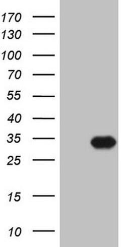 TNNI3 Mouse anti-Human, Clone: OTI4C1, lyophilized, TrueMAB 100 &mu;g;