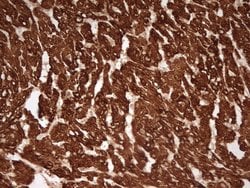 TNNT2 Monoclonal Antibody (OTI7D2), TrueMAB , OriGene 100 &mu;L; Unconjugated:Antibodies,