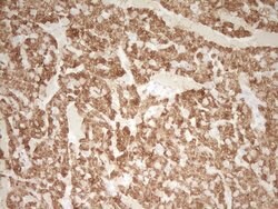 TNNT2 Mouse anti-Human, Clone: OTI3C6, lyophilized, TrueMAB 100 &mu;g;