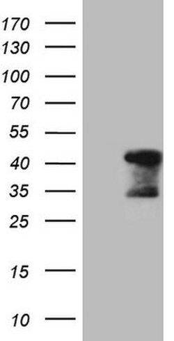TNNT2 Mouse anti-Human, Clone: OTI3C6, lyophilized, TrueMAB 100 &mu;g;