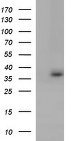 TOLLIP Mouse anti-Human, Clone: OTI2E6, liquid, TrueMAB 100 &mu;L; Unconjugated:Antibodies,