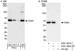 TOM1 Rabbit anti-Human, Polyclonal, Bethyl Laboratories 100 &mu;L; Unconjugated:Antibodies,
