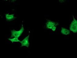 TOMM34 Monoclonal Antibody (OTI2A9), TrueMAB , OriGene 30 &mu;L; Unconjugated:Antibodies,